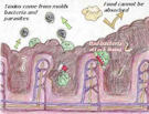 bad_intestines_135 bad_intestines_135