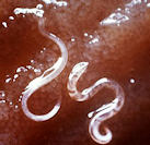 hook_worm hook_worm