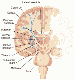 parkinsons_2 parkinsons_2