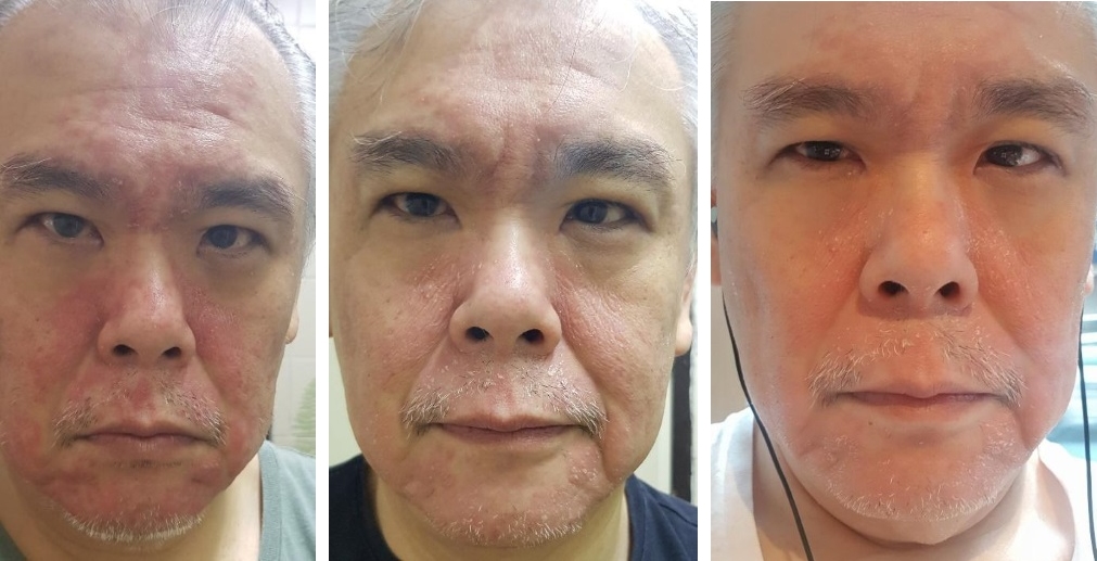 Skin Much Better