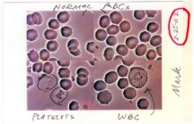 Mark Siegal Blood After Cleanse